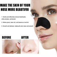Blackhead Removal Nose Strips™