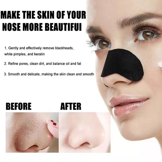 Blackhead Removal Nose Strips™