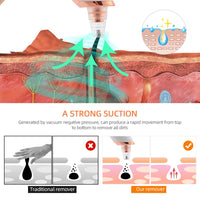 Blackhead Remover Machine™