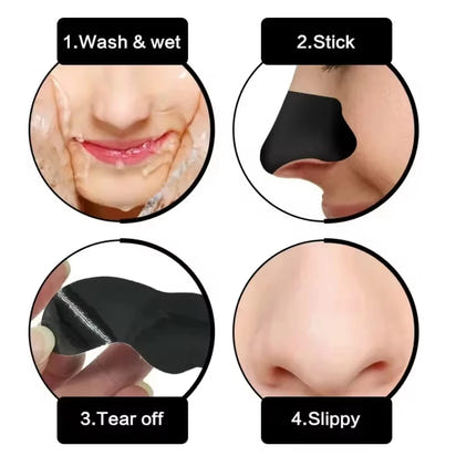 Blackhead Removal Nose Strips™