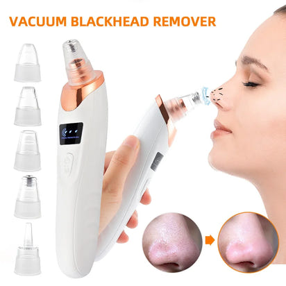 Blackhead Remover Machine™