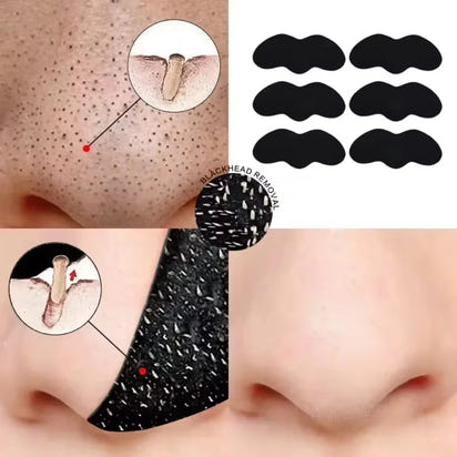 Blackhead Removal Nose Strips™